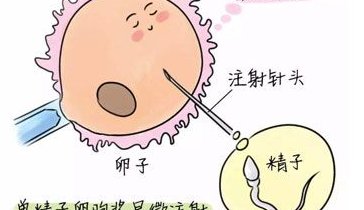 筛查银屑病三代试管来帮忙，国内排除准确率真不低！