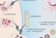 2026在南雄市做基因检测多少钱？基因筛查可以规避哪些遗传病？